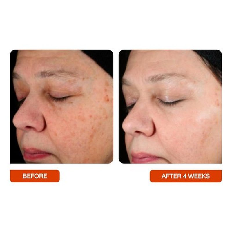 BeautyStat Universal C Skin Refiner - 20% Pure Vitamin C Serum for Radiant Skin | 30ml / 1.0 oz