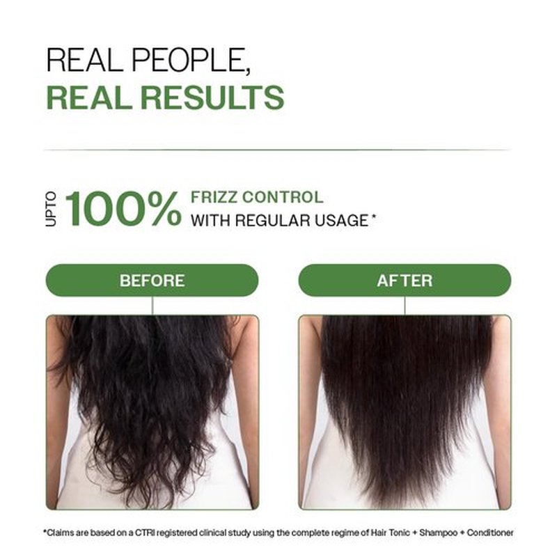 Bare Anatomy Anti-Dandruff Hair Conditioner with Biotin, Salicylic Acid & Rosemary | Removes Flaky Buildup | Moisturizes & Strengthens Hair | Reduces Frizz & Breakage | For All Hair Types | 175gm