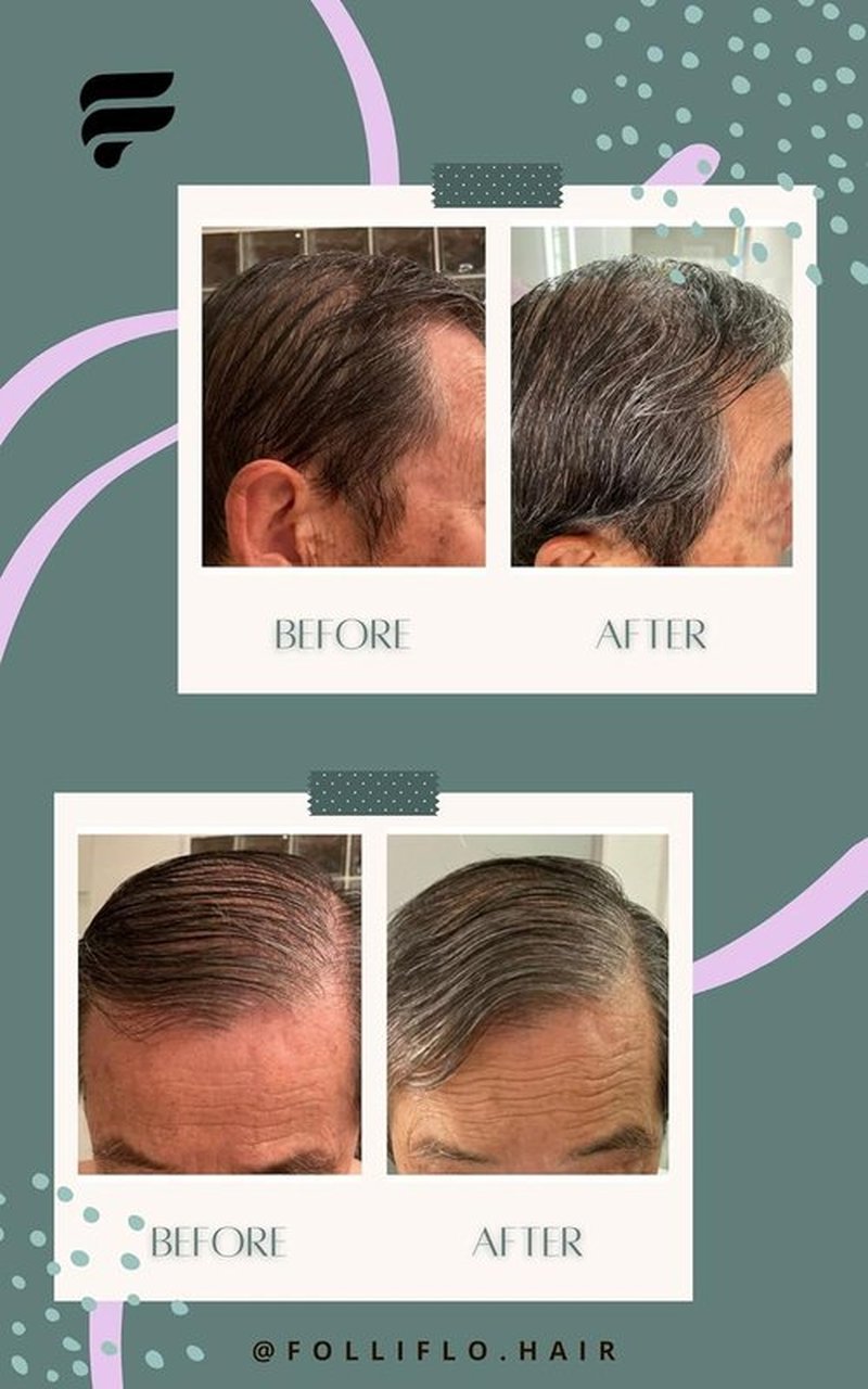 Folliflo Hair Boost Leave-In Conditioner Spray - Lightweight Serum for Thicker Hair | 90-Day Supply