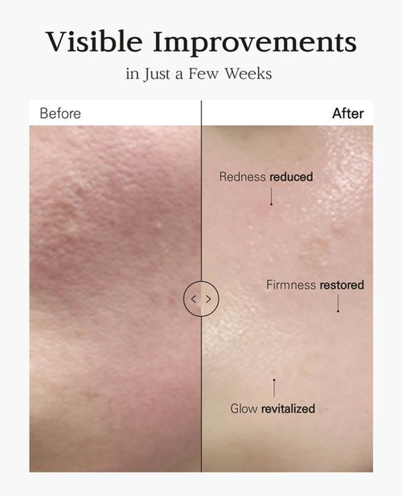 BLANC DUBU Nuborn Cell Placenta Stem Cell Intensive Repair Cream | Dragon Blood Cream with Placental Extract | Collagen Korean Skin Care for Glass Skin (50ml)