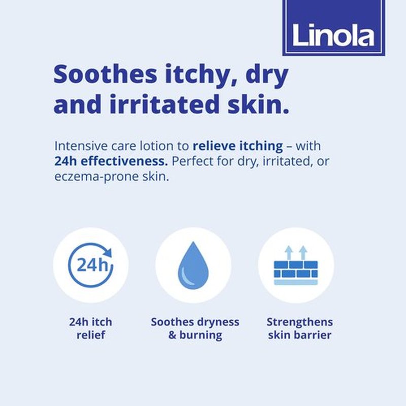 Linola Forte Lotion - Body Lotion with Essential Linoleic Acids - Nourishing Cream against Itching with 24-Hour Effect - Soothes Itchy, Dry & Irritated Skin - Made in Germany - 200 ml (6.8 Fl Oz)