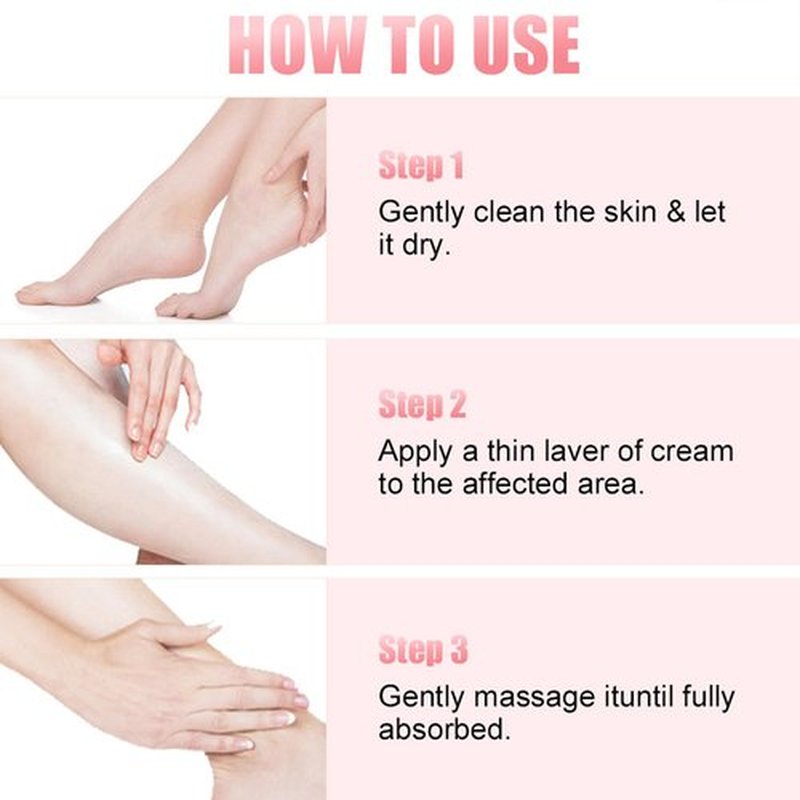 HJXUQIME 2pcs 60% Urea Hydrating and Anti-Cracking Foot Cream, 2025 Upgraded Moisturising and Relieves Cracking and Dryness Foot Cream for Dry Cracked Feet And Hands（aloe + peach）