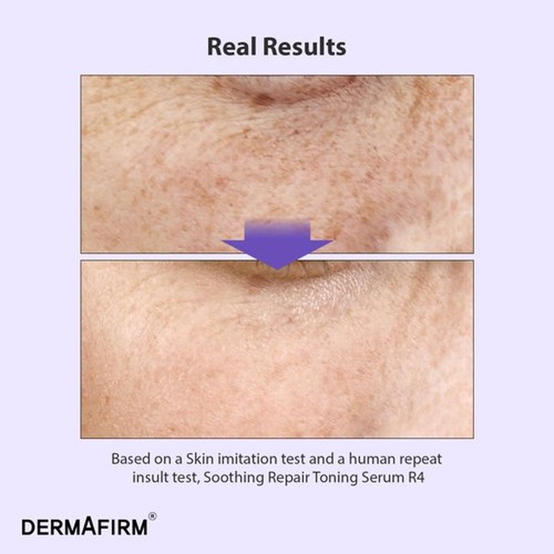 Dermafirm Bakuchiol Retinol Serum - Glass Skin Formula with Niacinamide & Peptides | Soothing Daily Care for Sensitive Skin