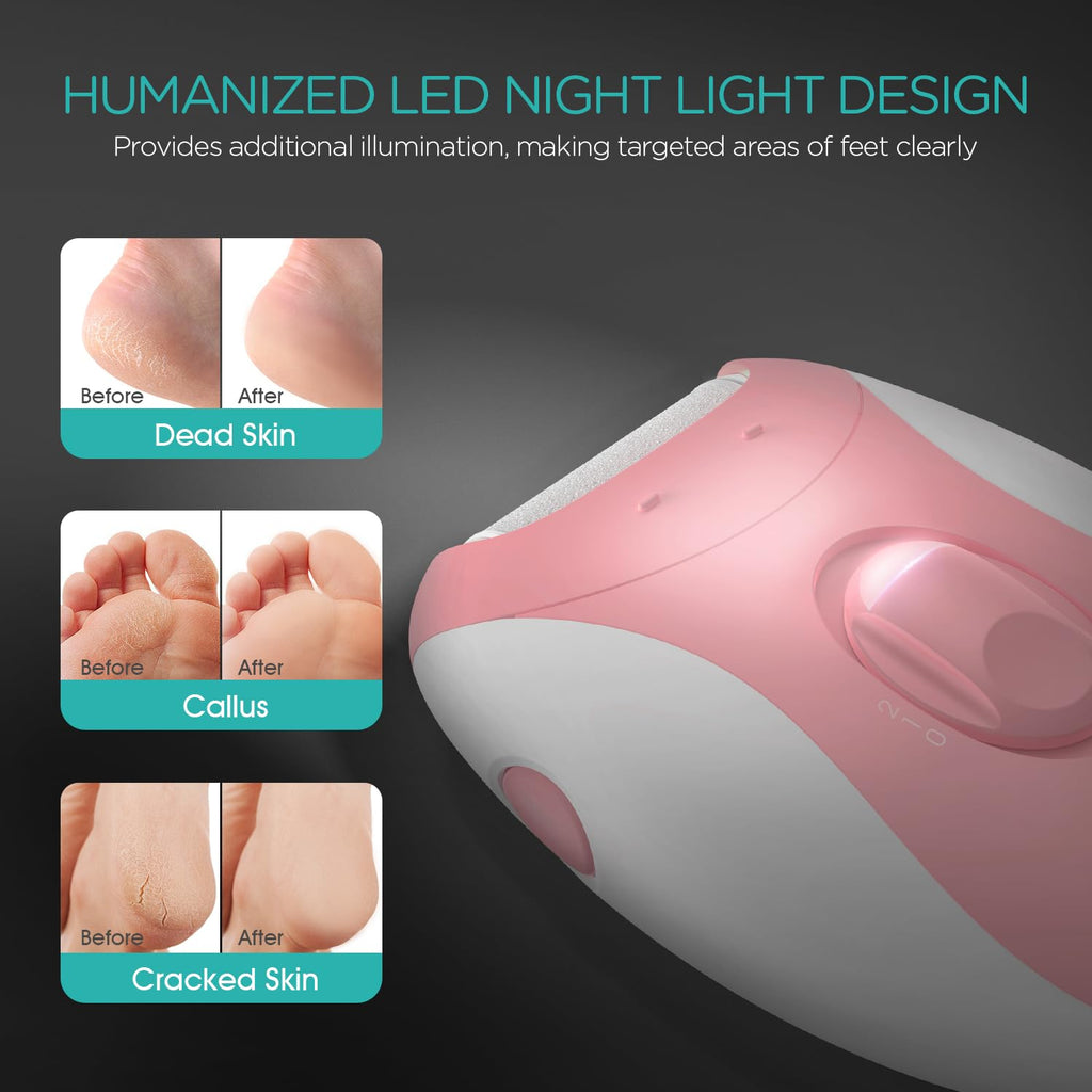 VOGOE Electric Callus Remover for Feet, Rechargeable Foot File Pedicure Tools with 3 Rollers & 2 Speeds, Professional Feet Scrubber Remover Foot Care for Calluses, Cracked Dry Dead Skin CR310 Pink