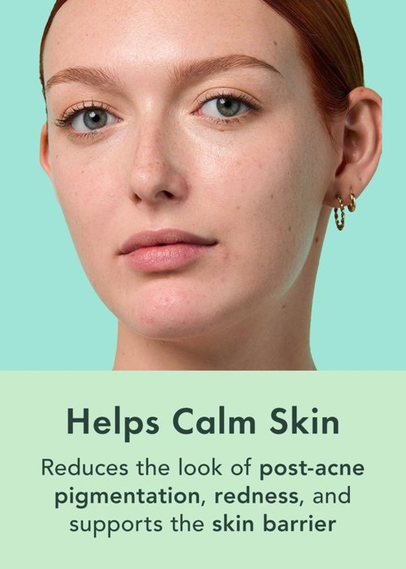 Rael Miracle Clear Serum - Salicylic Acid & Niacinamide Pore Minimizer for Radiant Skin (1 fl oz)