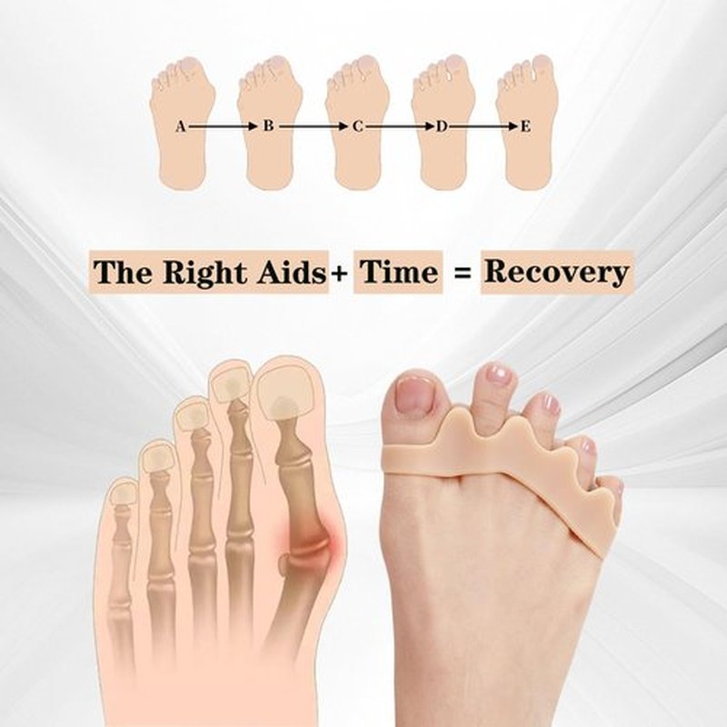 SANHLSKJ Big Toe Spacers Separators Bunion Corrector for Women Men,Yoga Gel, Foot Pain Relief and Health,1 pair Each