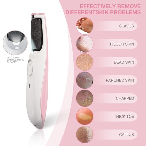 AM 8:00 Powerful Electric Foot Callus Remover, Rechargeable Pedicure Tool with Smart Light, Fine & Coarse Roller Heads, for Dead, Hard Cracked, Dry Skin (Pink)