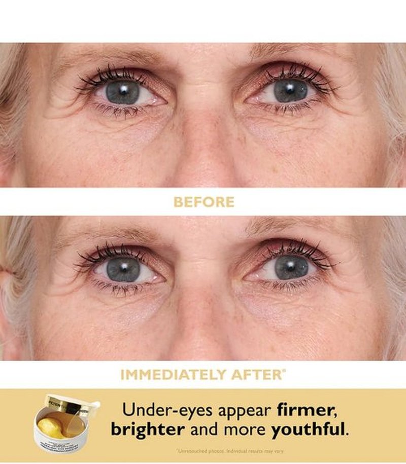 Peter Thomas Roth | Travel Pack Eye Patches - Hydrating & Revitalizing Treatment