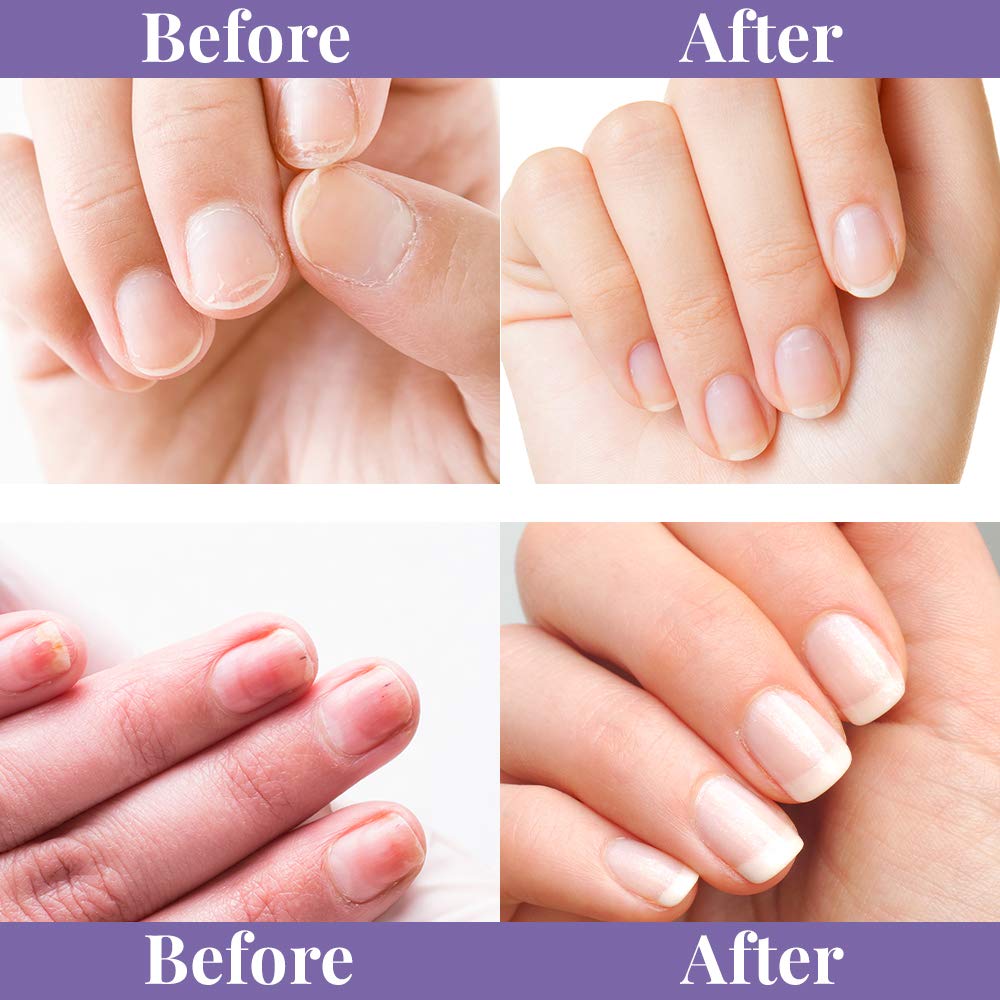 Winning Nails Chamois Buffer And Buffing Cream | Buff And Shine Dull Nails While Softening Cuticles | Assists With Fill And Repair Lines | 1.75 Oz. Set