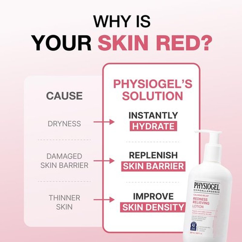 Physiogel Calming Relief Face and Body Lotion, Reduces Redness in just 3 days, Moisturizer for Dry, Red, Itchy, Sensitive Skin, Korean skin care, Fragrance-Free, Non-Comedogenic, Dermatologist-Tested