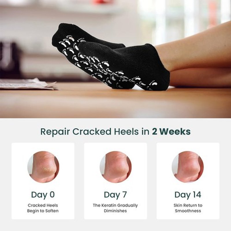Silicone Moisturizing Socks for Women & Men - Promifun 2 Pairs Moisturizer Socks for Dry Cracked Feet - Cracked Heel Repair - Heel Socks for Cracked Heel Treatment (W 6-9 / M 5-8, Black)