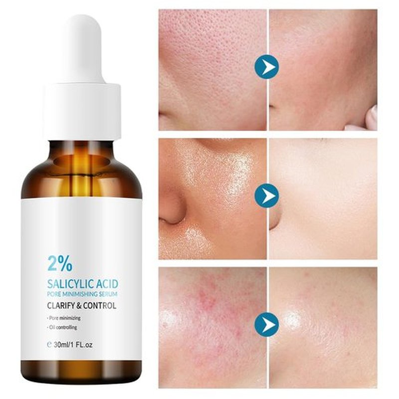 Regine Switzerland 2% Salicylic Acid Serum - Acne Treatment for Blackheads & Enlarged Pores