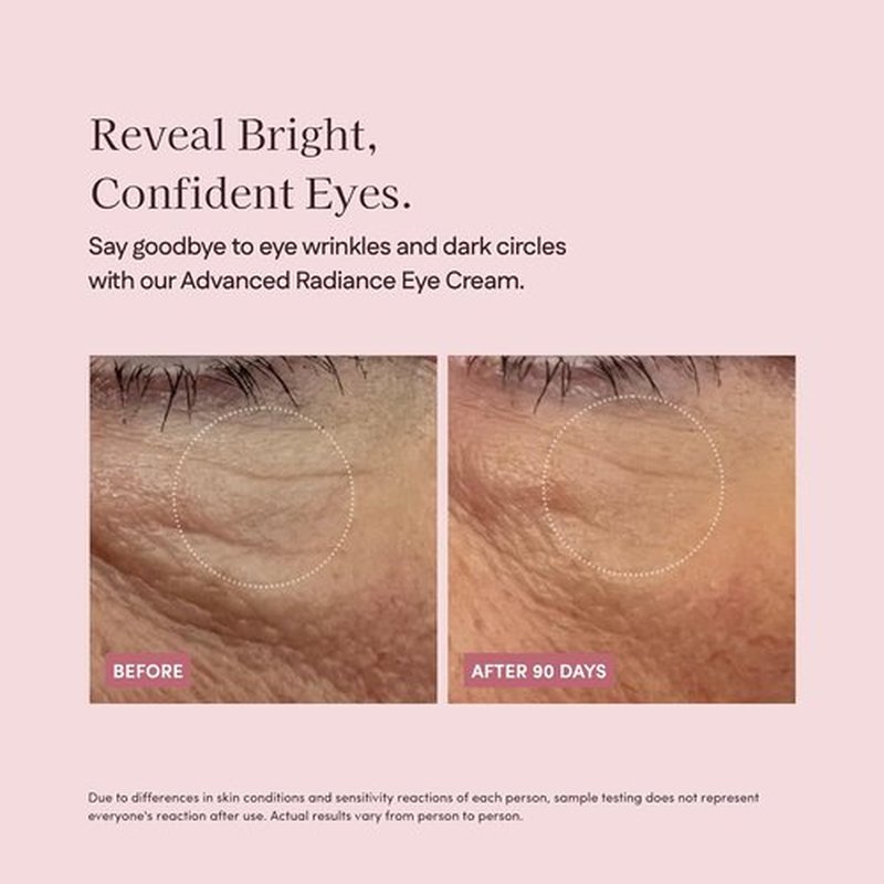 Pretti5 Advanced Radiance Eye Cream - Reduces Puffiness & Dark Circles | Vegan, 12g