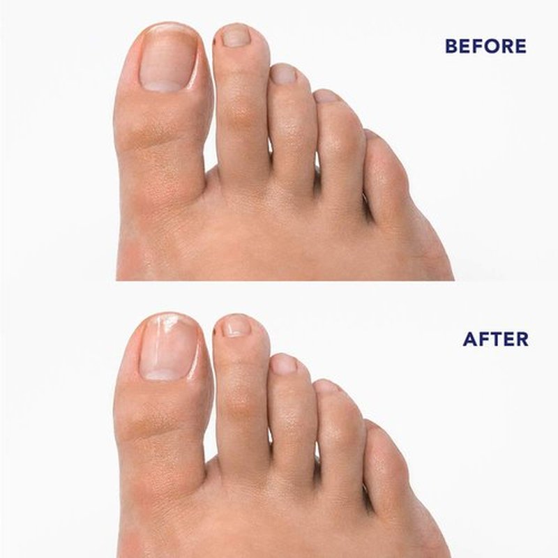 Barefoot Scientist Filed Away Advanced Nail Filing and Buffing Kit, Professional Quality Manicure and Pedicure