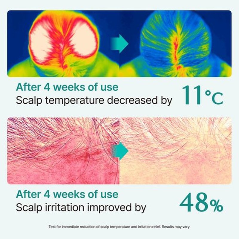 Lilyeve SCALPTURN Cica PDRN Scalp Serum - Strengthen Hair Roots & Relieve Itchy Scalp | 3.38 fl. oz.