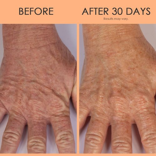 BODY FIRM Hand Repair Treatment - Anti-Aging Lotion with Shea Butter & Vitamin E | 3 fl oz for Dry Hands