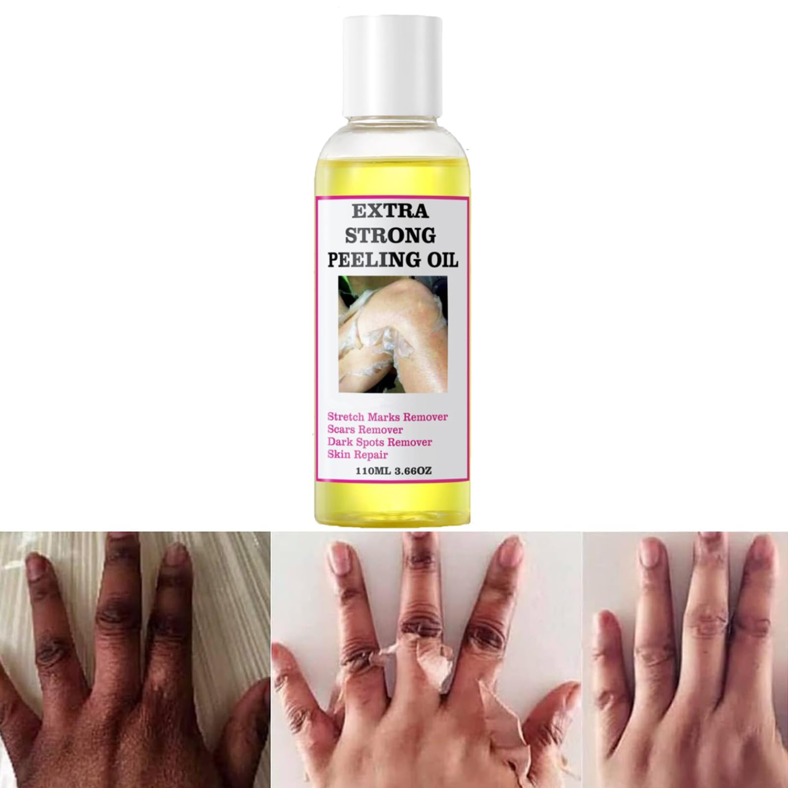Generic Extra Strong Yellow Peeling Oil for Dark Skin - Exfoliating Solution for Body, Hand, Feet and Face - All Skin Types (110ML/3.88 Fl Oz)