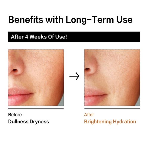 RAZUYEN Rice Toner with Aloe Leaf Water, Niacinamide and Centella Asiatica, Milky Toner for Soothing and Glowing Skin, Vegan, Alcohol and Fragrance Free