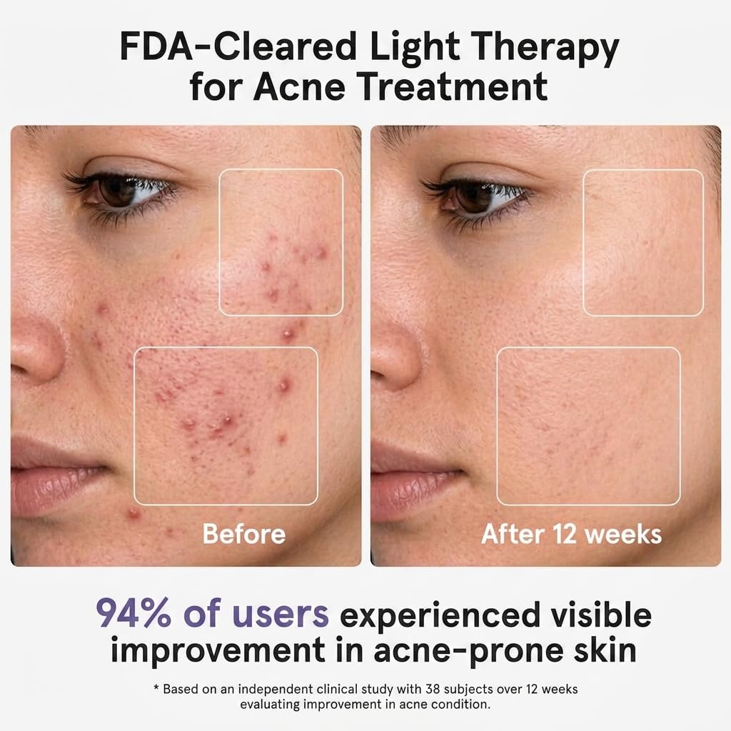 MICEYLIVE Red Light Therapy for Face with 432 LEDs & 3 Wavelengths (Red, Blue, NIR) - Targeting Wrinkles & Acne at Home, with Travel Bag & Eye Masks for Easy Skincare On The Go, White