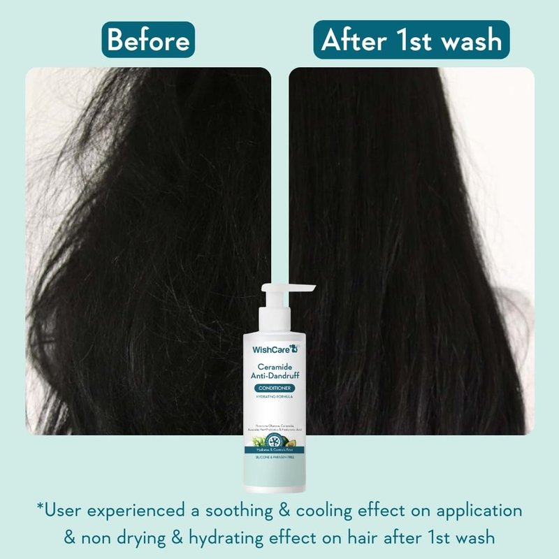 WishCare Anti Dandruff Conditioner for Dry & Frizzy Hair - 200 ML