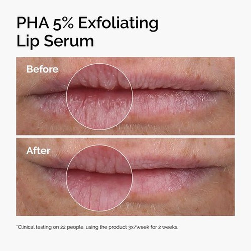 The Ordinary Lip Care Duo - Exfoliating Lip Serum & Hydrating Lip Balm Set | 0.5 Fl Oz