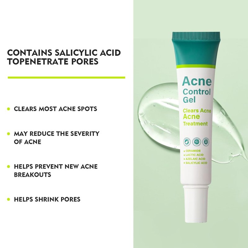 Azelaic Acid Serum by Regine Switzerland - Acne Treatment & Pore Refining Cream | 30ml for Sensitive Skin