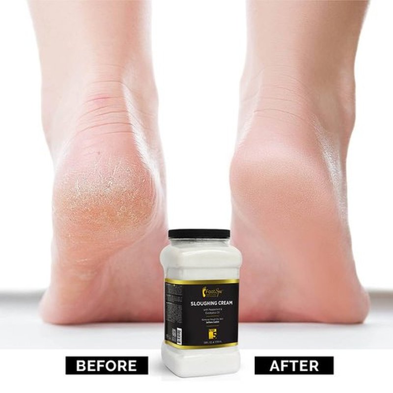 FootSpa - Foot Cream, Sloughing Lotion, Peppermint and Eucalyptus Oil, 128 Oz - Pedicure Massage Foot Care for Dry Cracked Feet, Scrub Gently, Exfoliating
