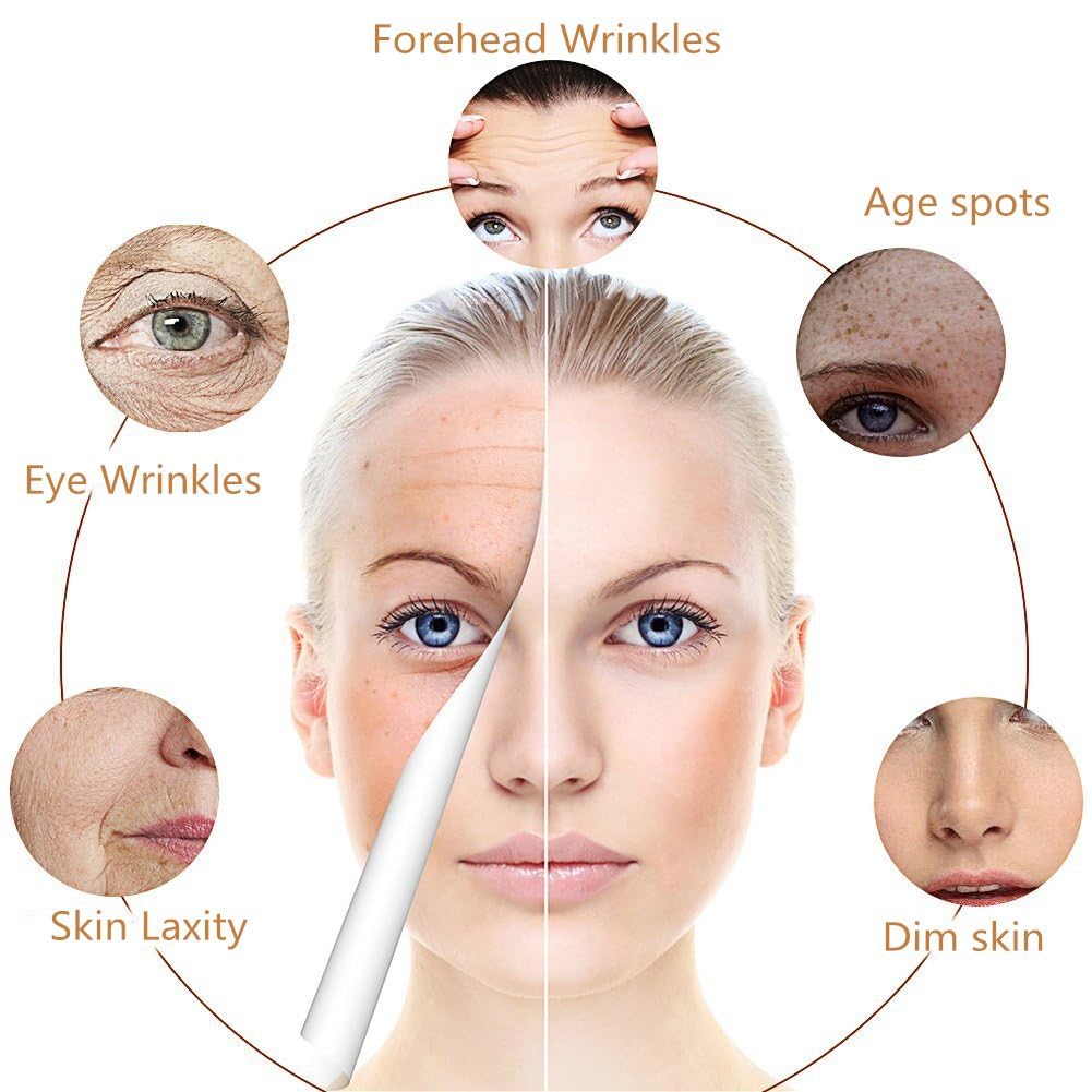 20% Vitamin C Face Serum With Hyaluronic Acid and Vitamin E- Facial Serum - Fade Dark Spots, Acne & Wrinkles, Smoothing Skin Serum for Face and Eye (1 fl.oz)