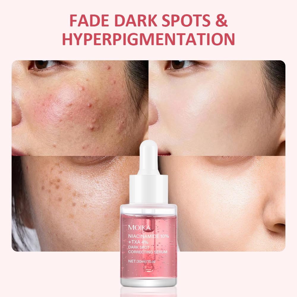 Niacinamide 10% + TXA 4% Dark Spot Corrector Serum, All-in-One Face Serum with Hyaluronic Acid, Hydrating & Soothing, Helps Improve Skin Texture & Tone, For Sensitive Skin 1 Fl Oz