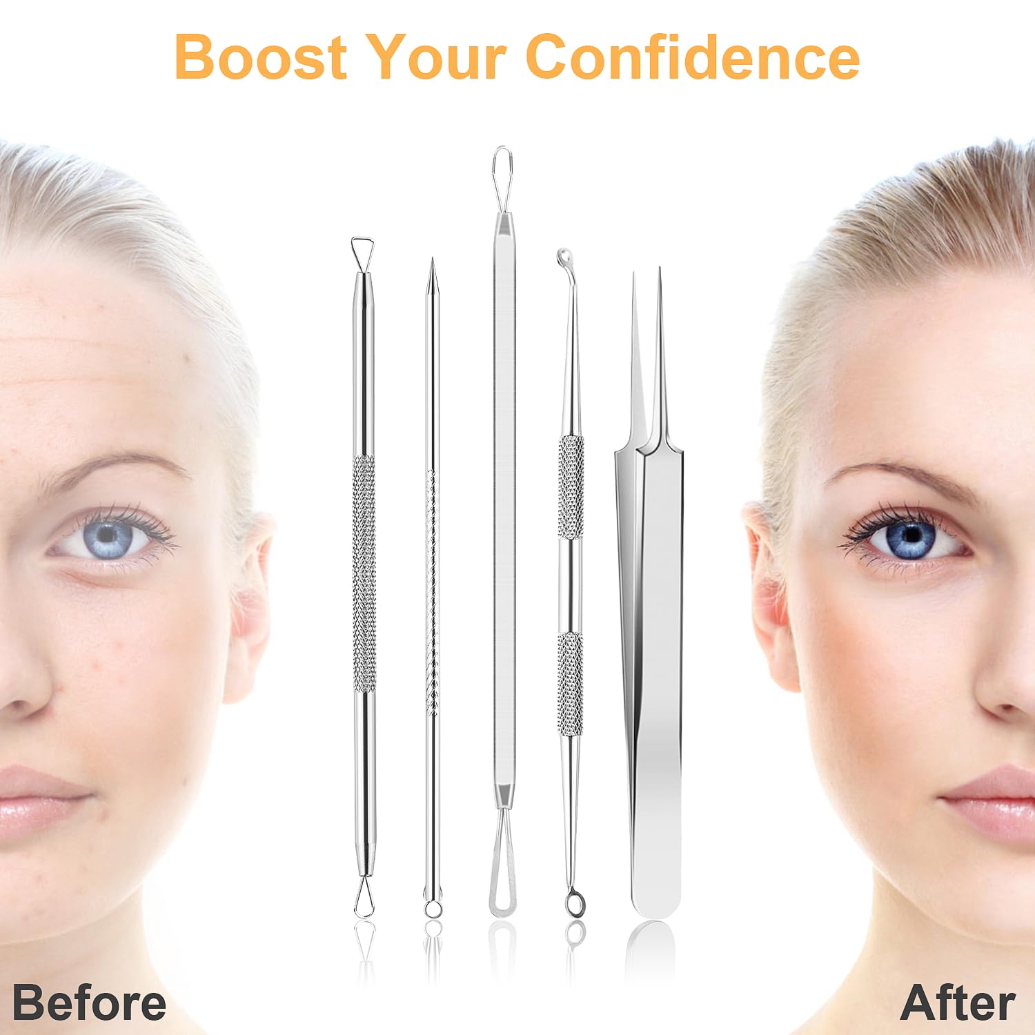 UUBAAR 9PCS Blackhead Remover Tools, Pimple Popper Tool Kit with 2 Tweezers, 304 Stainless Steel Comedone Extractor, 16 Precision Heads Face Nose Acne Zit Removal, Home Esthetician Use & Leather Case