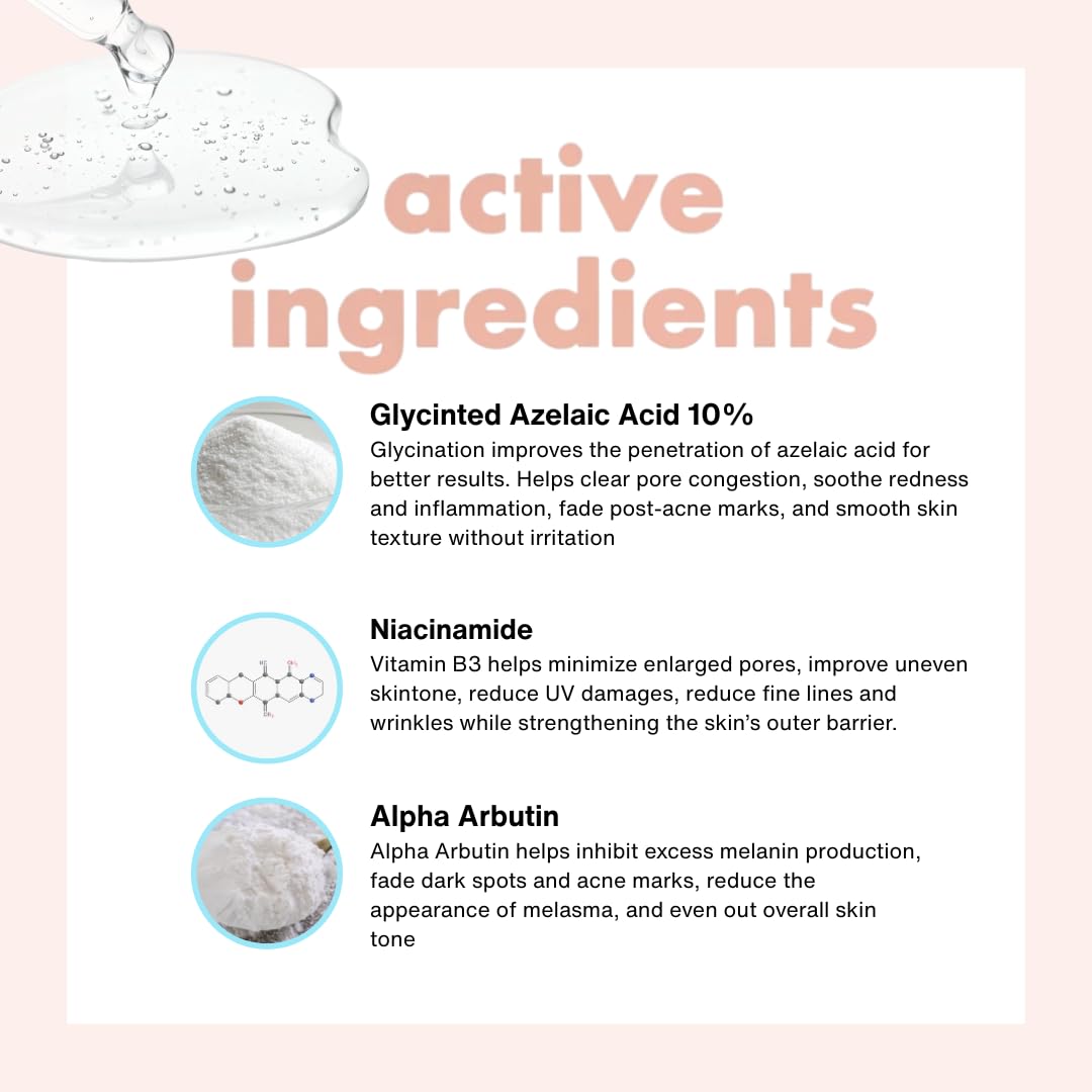 Saranghae Azalume 10 Clarifying Serum – Azelaic Acid, Niacinamide & Alpha Arbutin – Face Serum for Blemish-Prone Skin, Dark Spots – Brightening & Pore Minimizing Skincare – 1oz