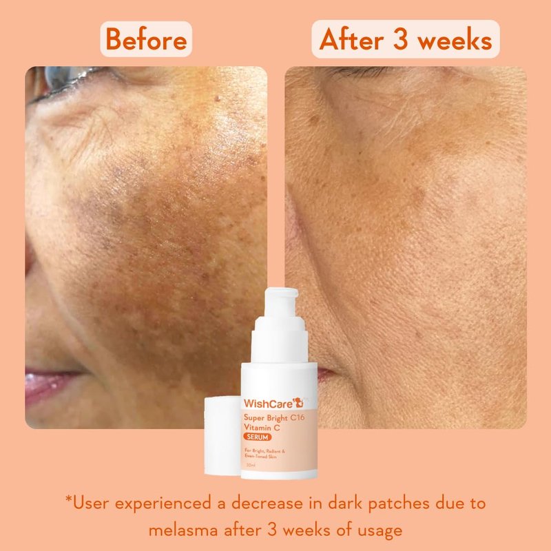 WishCare Vitamin C Face Serum with Niacinamide, Ferulic Acid & Botanical Extracts – Serum for All Skin Types, 30ml