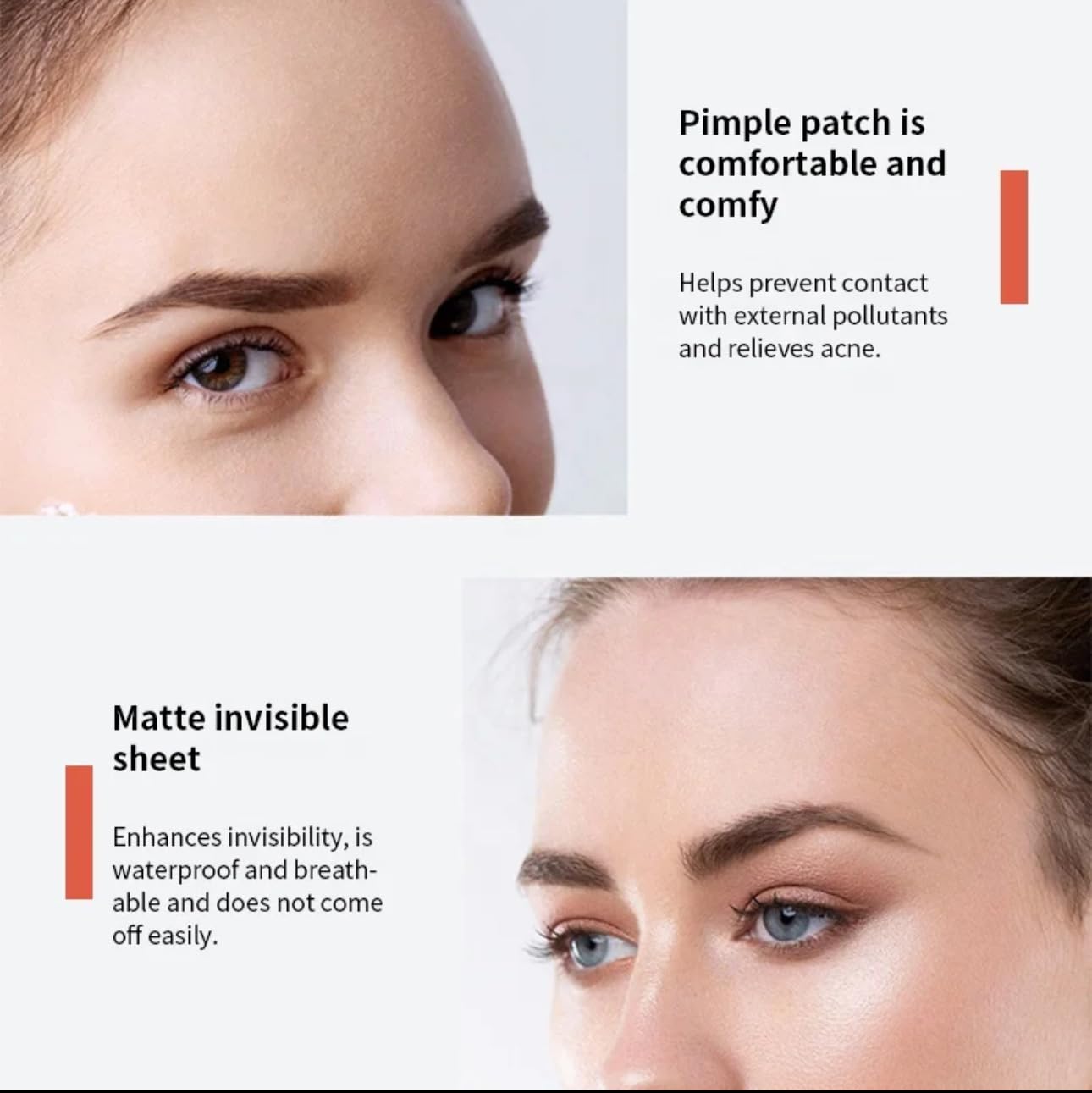 kisskin ZitZap Pimple/Acne Patches For Face And Skin, Hydrocolloid Patches With Salicylic Acid And Tea Tree Oil For Covering Zits And Blemishes.