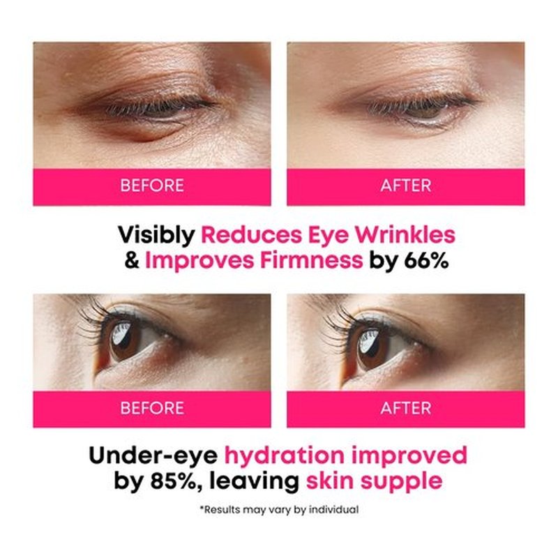 Skiennix 360° Collagen Eye Masks - Korean Under Eye Patches for Fine Lines & Dark Circles | 50 Masks