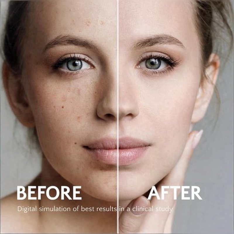 Regine Switzerland Dark Spot Brightening Cream - 4% Hydroquinone, Non-Irritating Hydration, 1oz
