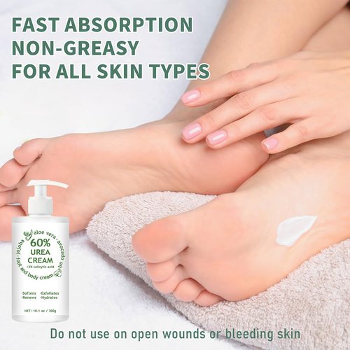 60% Urea Cream Maximum Strength, 10.1 oz - Foot & Hand Cream for Dry Cracked Skin, Callus Remover, with 2% Salicylic Acid - Deep Moisturizer for Cracked Heels, Rough Elbows & Knees - Fast Absorbing