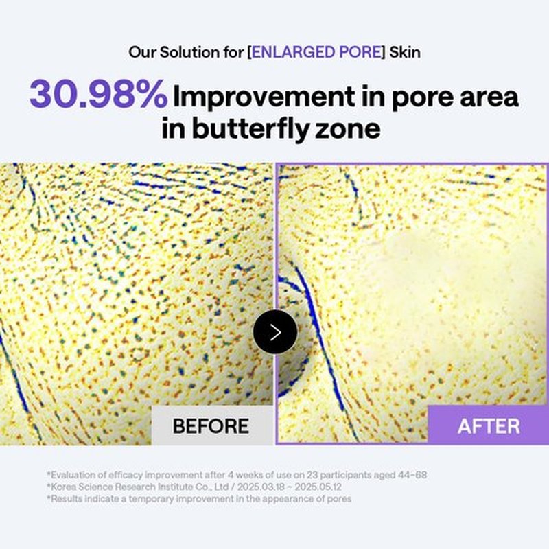 MEDIHEAL Toner Pads [PDRN] - Stretchable Lifting Pads with Squalane and Glutathione for Total Skin Care - Plant Based Rose PDRN - Wrinkle & Pore Care - Vegan Stretchable Lifting Fabric (100 Count)