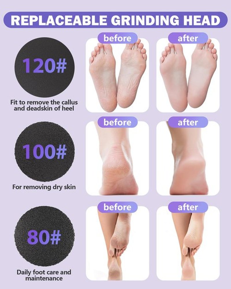 AvantShine Electric Foot Callus Remover, Callus Remover for Feet with 60 Pcs Sandpaper Discs, Rechargeable & Adjustable Speeds LED Display, 2-in-1 Electric Foot File for Dead Skin Removal & Nail Care