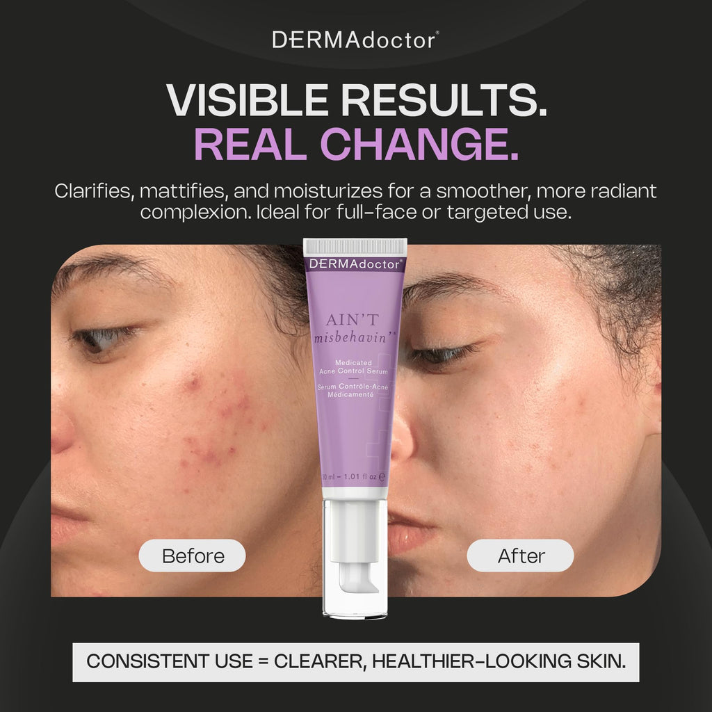 DERMAdoctor Ain't Misbehavin' Dermatologist Formulated Salicylic Acid Acne Control Serum, Acne Spot Treatment for Blemish Control and Cystic Acne breakouts with Tea Tree - 1 oz