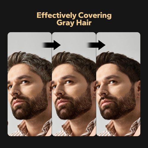 HyperHair Dark Brown Hair Dye Shampoo, Shampoos for Color Treated Hair, Hair Dye Shampoo 3 In 1, Hair Dye, Shampoos for Gray Hair for Women & Men, Long Lasting & Coverage