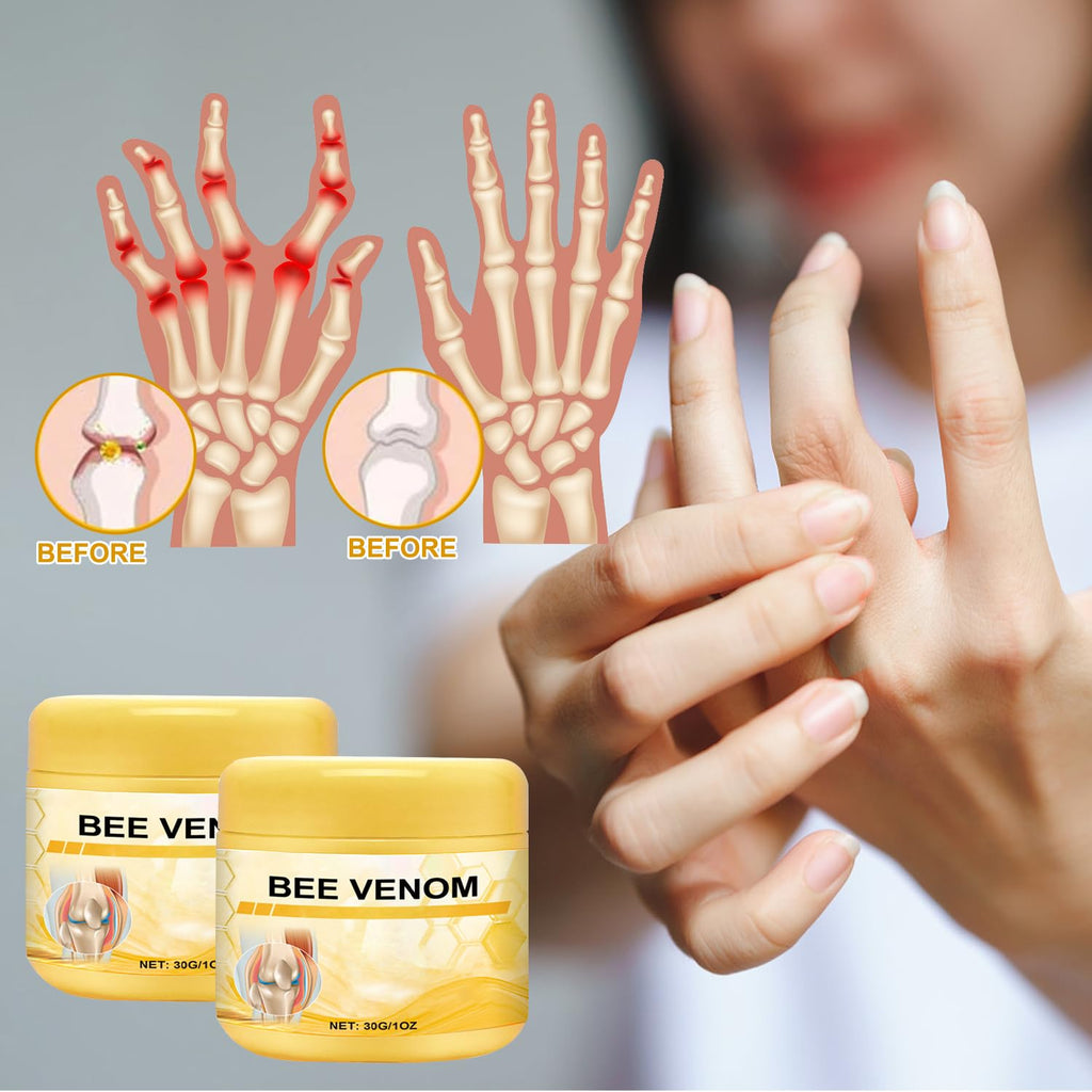 Botou 2PCS New Bee Venom Professional Joint Cream, for Neck, Waist, Back, Hands, Feet and Legs Advanced Bee Propolis Joint Cream, yellow