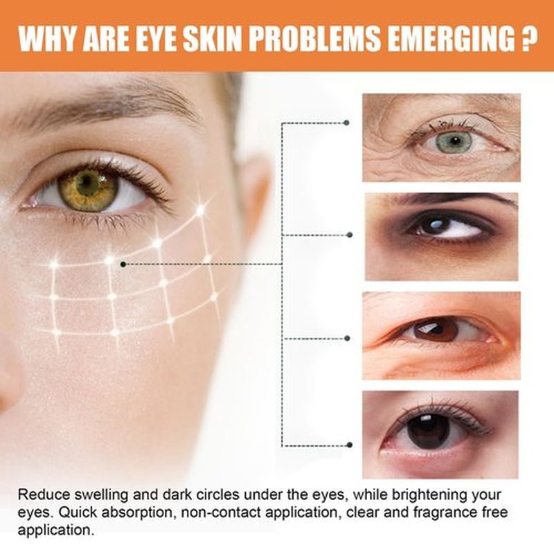 LOYOTICE Vitamin C Eye Balm - Hydrating & Brightening Eye Cream Stick | Reduces Dark Circles & Puffiness