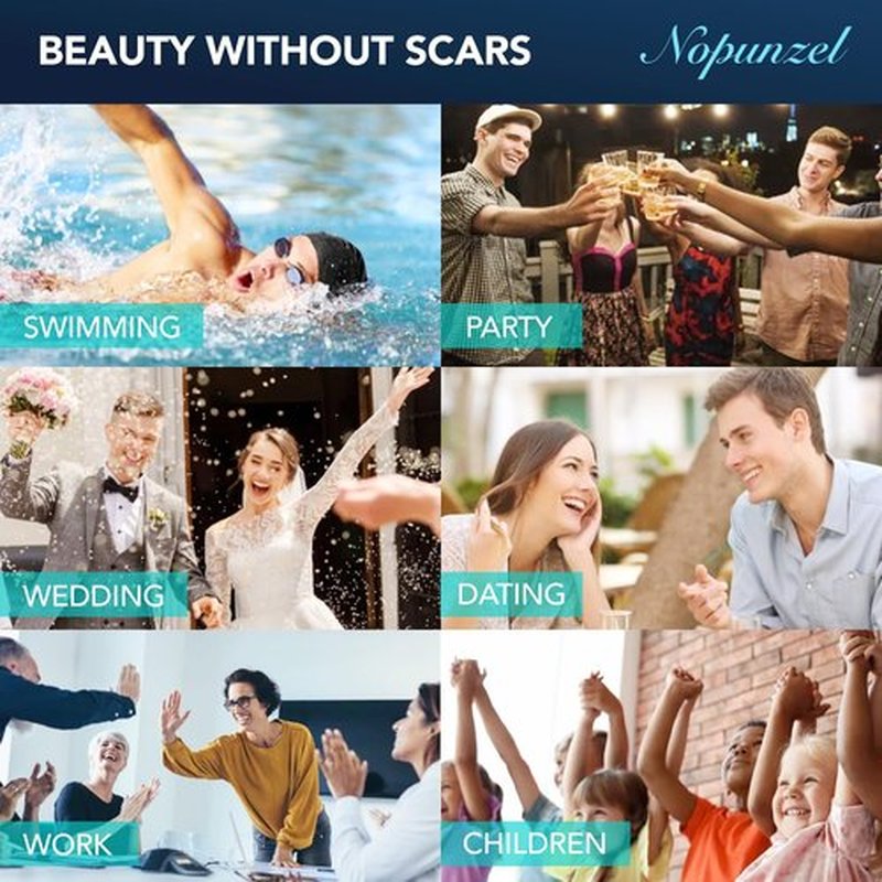 Silicone Scar Gel: Silicone Gel for Scars - Improve Scar Appearance for Old and New Scars - Medical Grade Silicone - Advanced Scar Gel - Scalds - Surgery - Injury - Stitches - Burns - 20g
