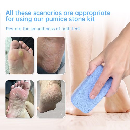 LIGOFLORA Glass Pumice Stone for Feet Callus Remover, 4-in-1 Foot Scrubber Kit with Dual-Sided Large Pumice Stones, Cone Foot Exfoliator and Nail Cleaning Brush, Blue & White