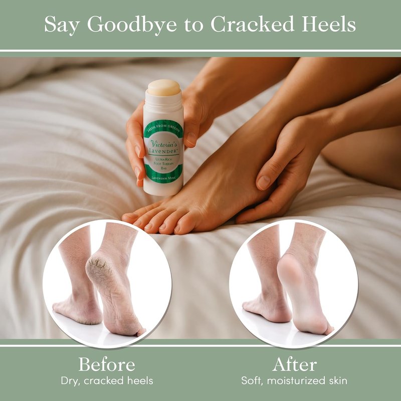 Victoria's Lavender Heel Balm Stick - Ultra-Rich Foot Therapy for Dry, Cracked Feet - 2.5oz Lavender Mint