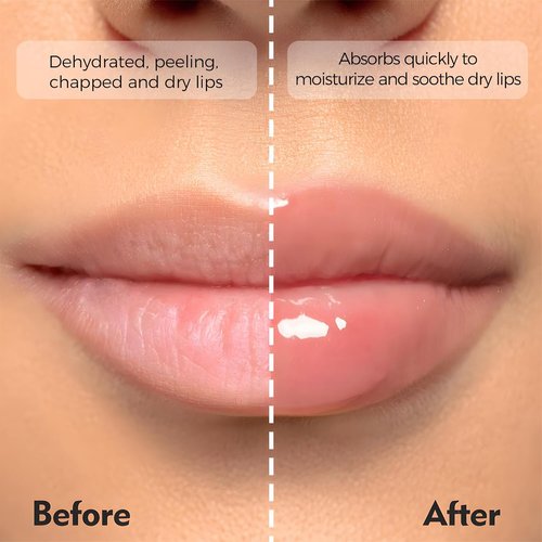 Skiennix Deep Hydrating Lip Butter Balm - Glossy Vegan Treatment with Shea Butter & Vitamin E | 2-Pack (Clear-Unscented)