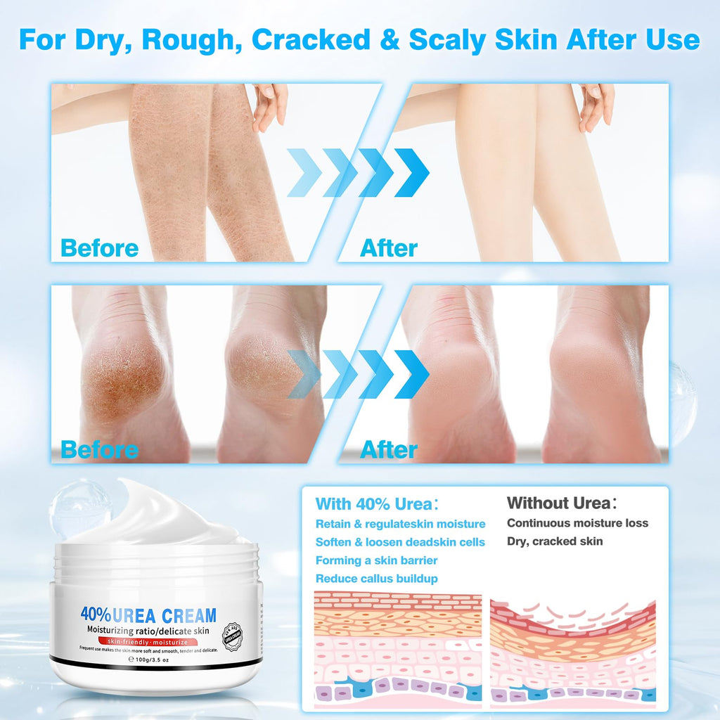 Yunmeng Urea Cream 40 Percent for Feet Maximum Strength, with Foot Mask Covers(50 pairs), Foot Cream for Dry Cracked Heels and Feet, Soft Feel Urea Lotion, 3.5 OZ, Foot Files