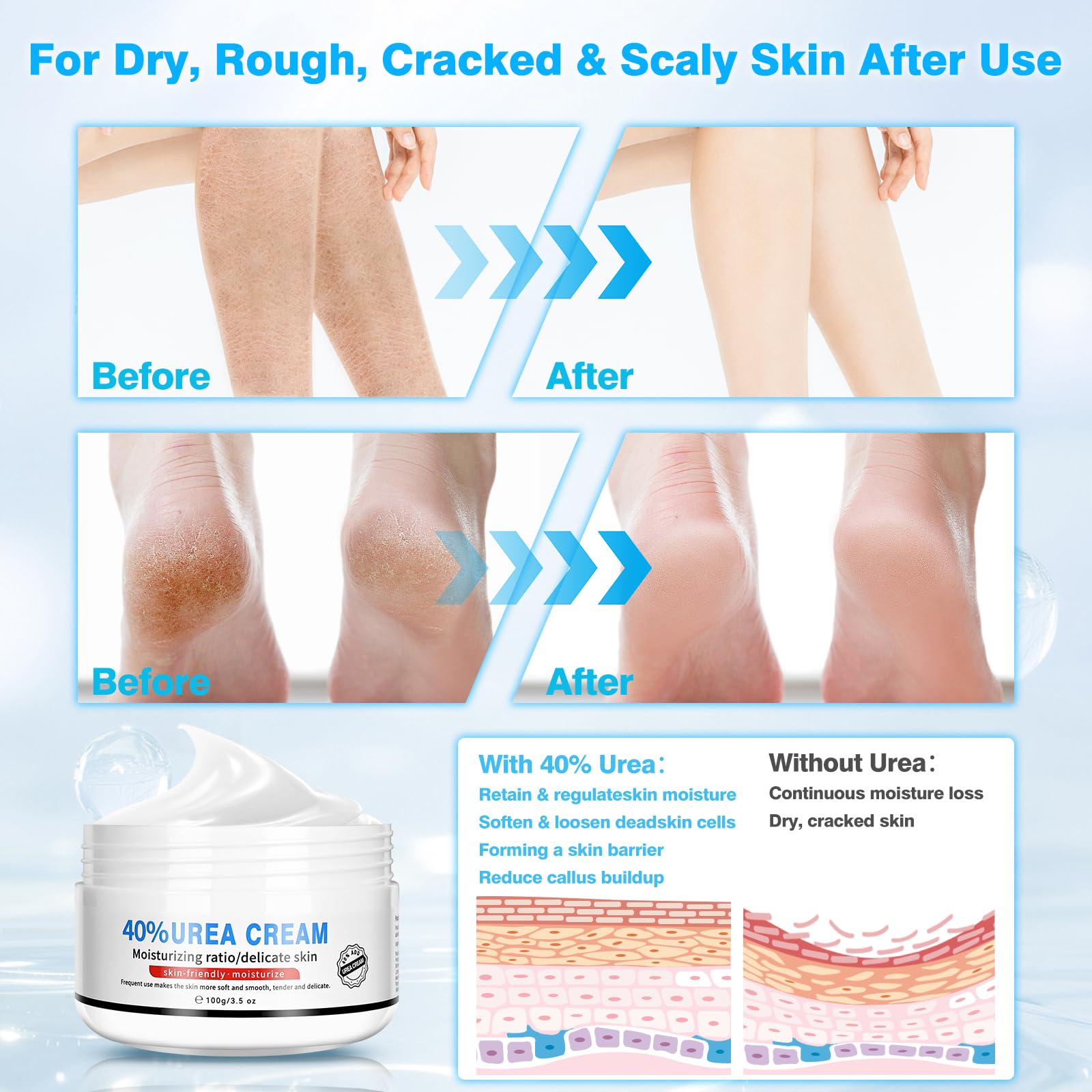 Yunmeng Urea Cream 40 Percent for Feet Maximum Strength, with Foot Mask Covers(50 pairs), Foot Cream for Dry Cracked Heels and Feet, Soft Feel Urea Lotion, 3.5 OZ, Foot Files