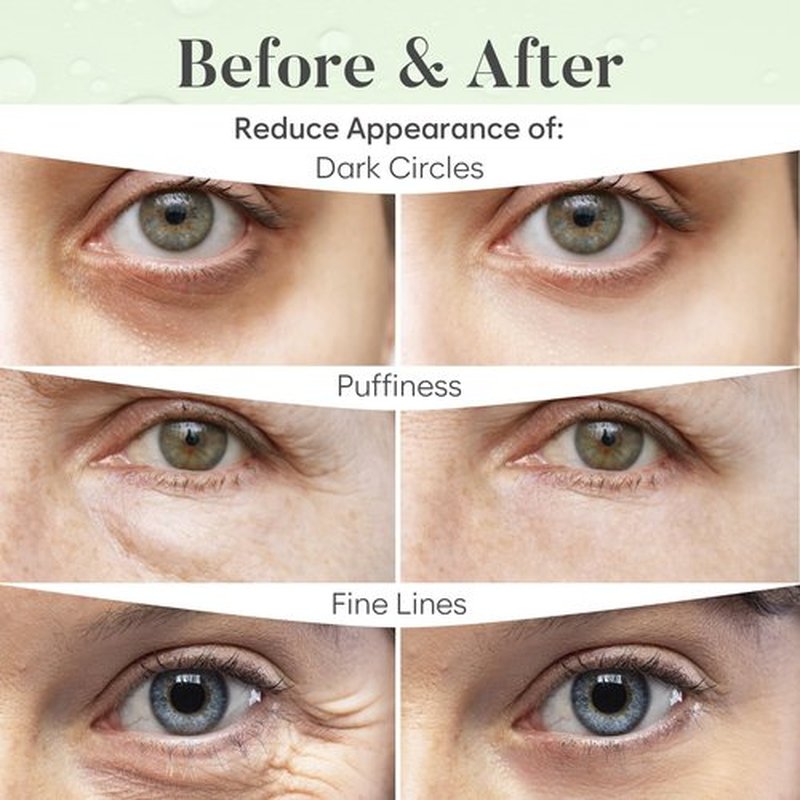 BLOOMORA Green Tea Under Eye Patches (20 Pairs) - Dark Circles & Puffiness Care - Hydrating Green Tea Eye Mask