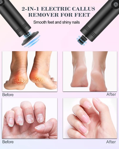 2 in 1 Electric Foot Callus Remover, 9 Speed Adjustable Foot Sander with LED Display, Electric Foot Grinder with 2000 mAh Rechargeable Battery, for Callus Removal, Replaceable Sandpaper Discs (Black)
